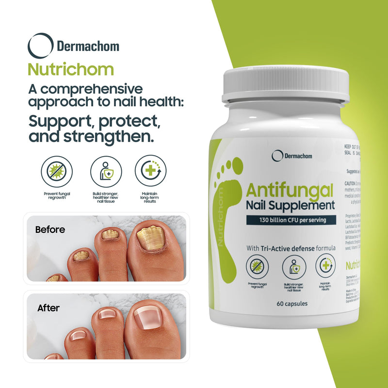Nutrichom Probiotic Fungal Nail Cleaner Supplement – Fights Fungus & Supports Healthy Nails with Vitamins & Natural Ingredients – 60 Capsules