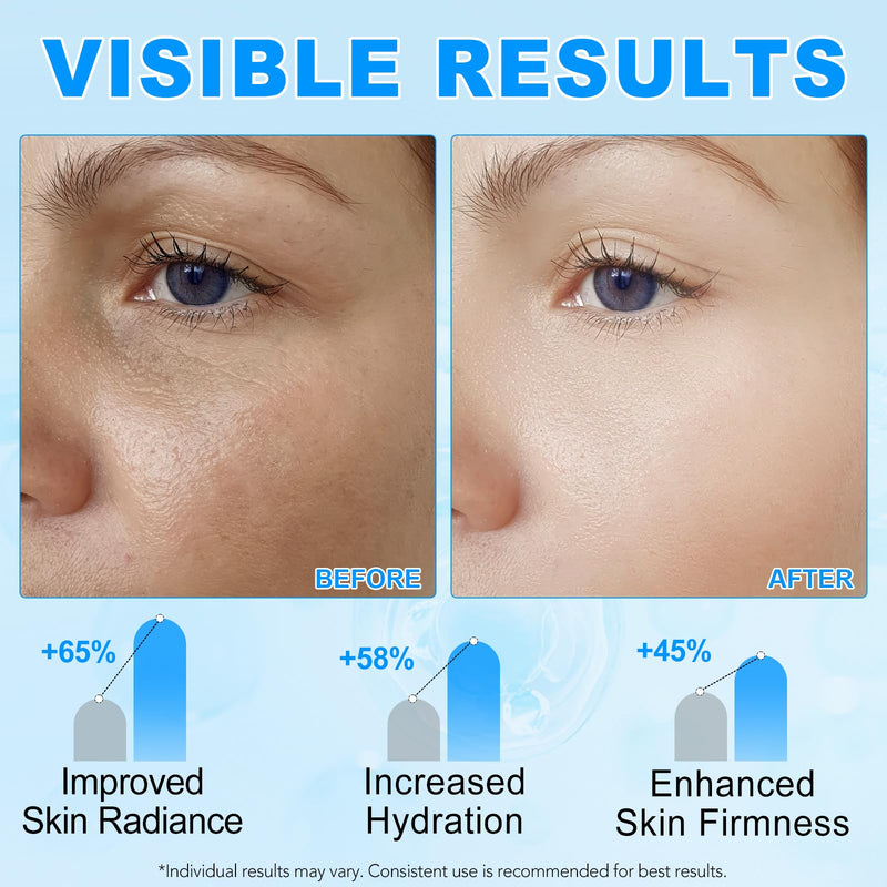 Hyaluronic Acid Powder, Water-soluble High Molecular Weight Hyaluronic Acid Serums Powder, Water Soluble Hydrating Ingredient for Skin Moisture, Hyaluronic-skincare-molecular-hydrating-ingredient