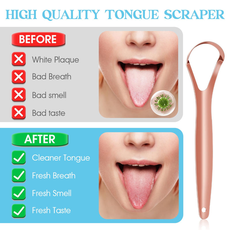 [Australia] - 4 Pack Tongue Scraper for Adults and Kids,100% Stainless Steel Tongue Scraper with Travel Case,Reduce Bad Breath,Easy to Use and Carry,Metal Tongue Scraper for Oral Care&Hygiene,Rose Gold Rose Gold 