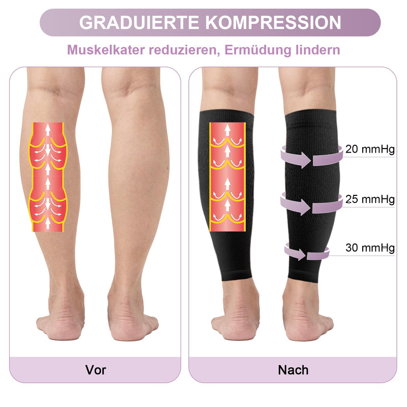 [Australia] - Migliore Wear 2 PAIRS of compression stockings for women and men, 20-30 mmHg | Class 2 Medical Compression Stockings, Graduated Support Support Stockings Thrombosis Stockings M Black 