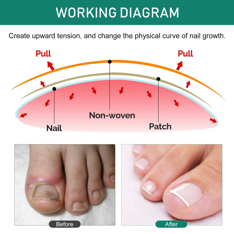 Nail Care Patches, Gentle Adhesive Design, Invisible Comfort, Easy to Apply, Breathable Material, Suitable for Daily Toenail & Fingernails
