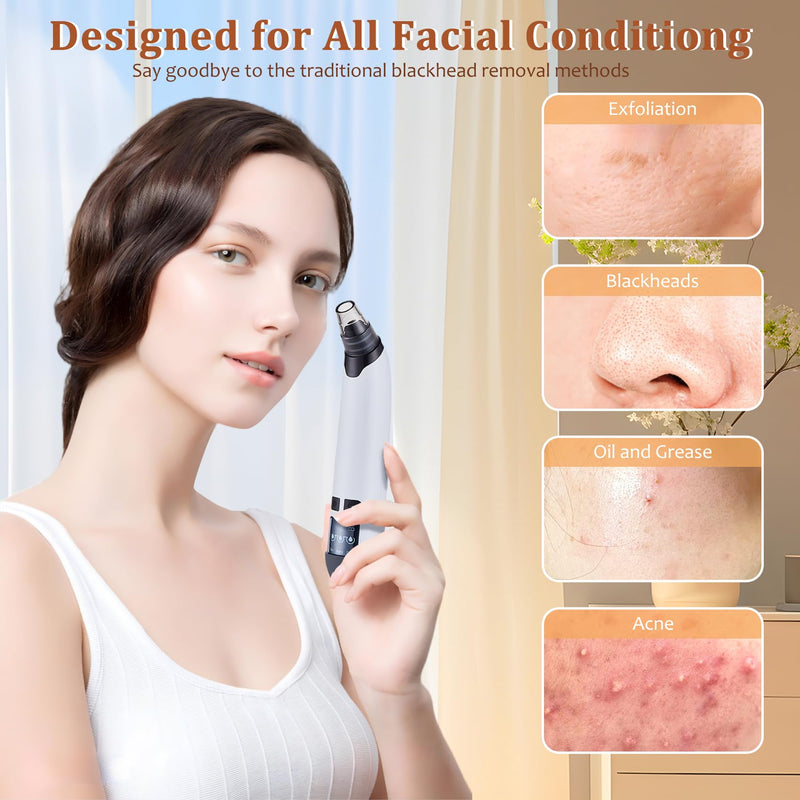 Blackhead Remover Vacuum - Powerful Pore Vacuum for Cleansing, Blackhead Extractor with 3 Adjustable Suction Levels, 4 Blackhead Removal Tools, USB Rechargeable，Suitable for Women and Men
