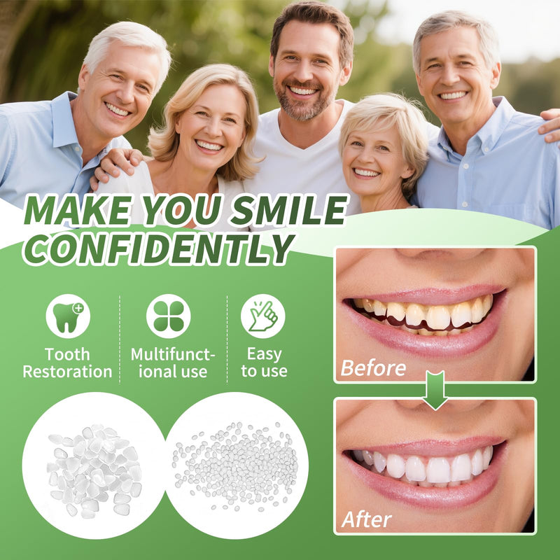 Tooth Repair kit for Filling The Missing Broken Tooth and Gaps-Moldable Fake Teeth and Thermal Beads Replacement Kit-White-A04