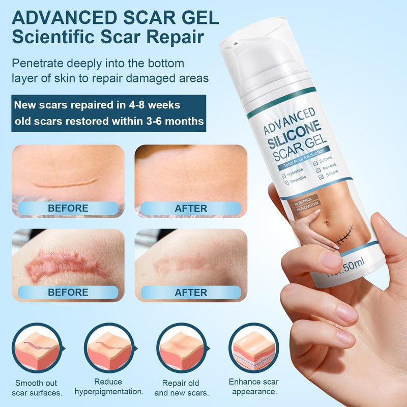 [Australia] - Advanced Scar Gel, Silicone Scar Gel, Treats Old and New Scars, Reduces the Appearance of Scars from, Body, Face, Stretch Marks, Surgical Scar, Keloids, Acne, Burns and More, 50g (1.76 Oz) 