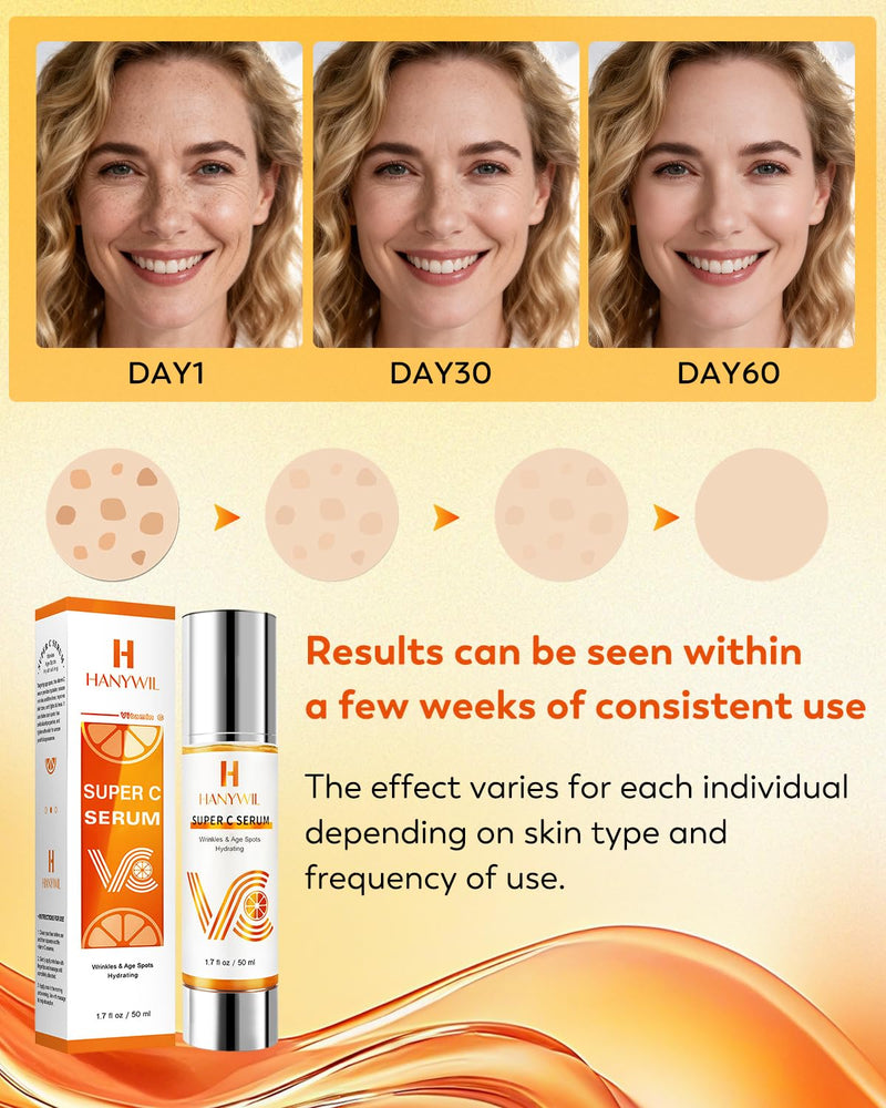 HANYWIL Vitamin C Serum for Mature Skin, 20% Vitamin C Face Serum with Hyaluronic Acid, Dark Spot Remover, Hydrating Skincare for Wrinkle Reduction, Lifting & Firming - 1.7 fl 1.7 Fl Oz (Pack of 1)