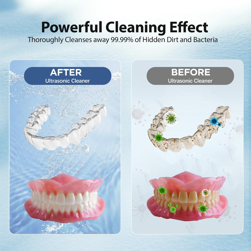 [Australia] - Ultrasonic Cleaner for Retainer Cleaning Machine: 43000Hz Sonic Dental Clean Pod for Denture Mouth Guard 