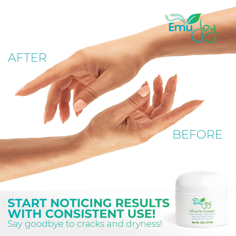 [Australia] - Emu Joy Miracle Cream - Hand & Foot Callus Remover Cream, Intensive Moisturizing Cream for Dry Heels and Soles, No More Foot Scrubbers & Files, Get Professional Salon Pedicure At Home (2 oz.) 