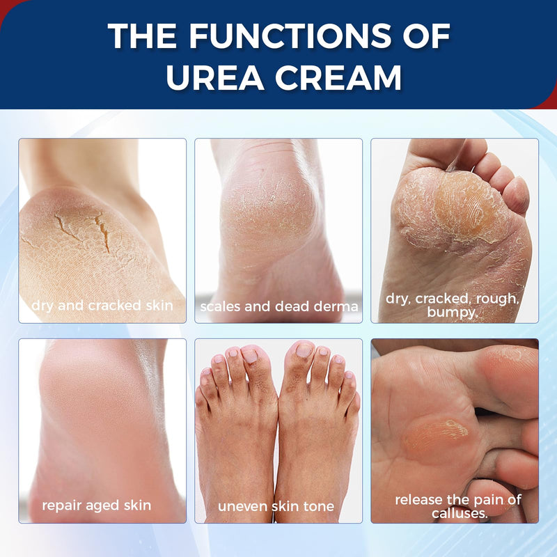 OUKEYA 42% Urea Cream for Dry Rough Skin, Contain Nano Glass Foot File | 3 Oz Tube, 2% Salicylic Acid, Moisturize Lotion, Exfoliating, Heels Care, Hands, Elbows Knees, Softening, Non-Greasy 3 Ounce with Foot File