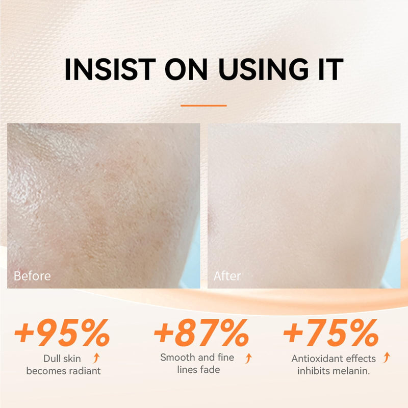 20% Vitamin C Face Serum with Hyaluronic Acid, 1.0 Fl Oz | for Mature Skin, Fine Lines & Dry Areas; With Vitamin E, Niacinamide & Aloe For Daily Am/Pm Skincare