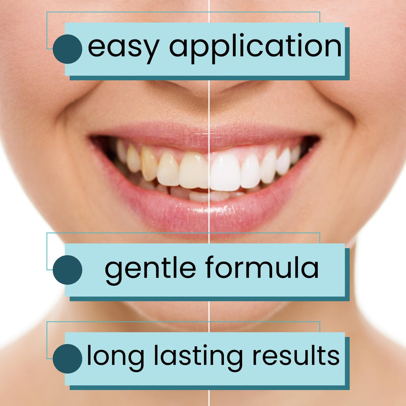 Natural Teeth Whitening Strips – Enamel Safe Gentle Whitening for Sensitive Teeth, Vegan-Friendly White Strips Without Peroxide or Bleach, 14-Day Treatment with 28 Count Supply
