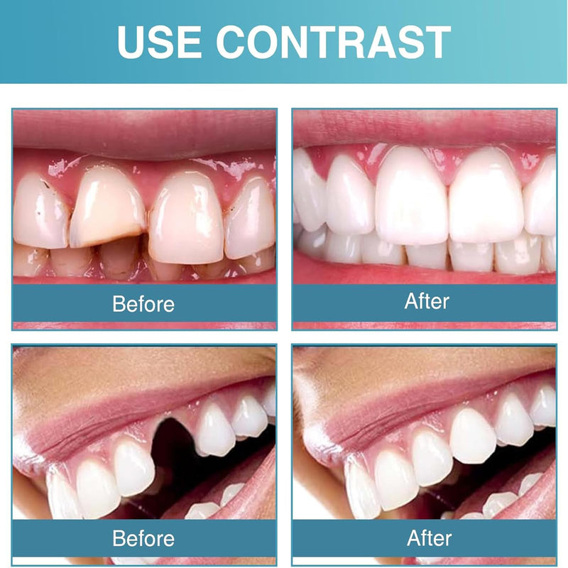 Generic 2 Pair Veneers Silicone Denture Set, Full Dentaduras Upper and Lower for Smile Easy Suitable, Dentures for Men Women with No Teeth Everyday Use