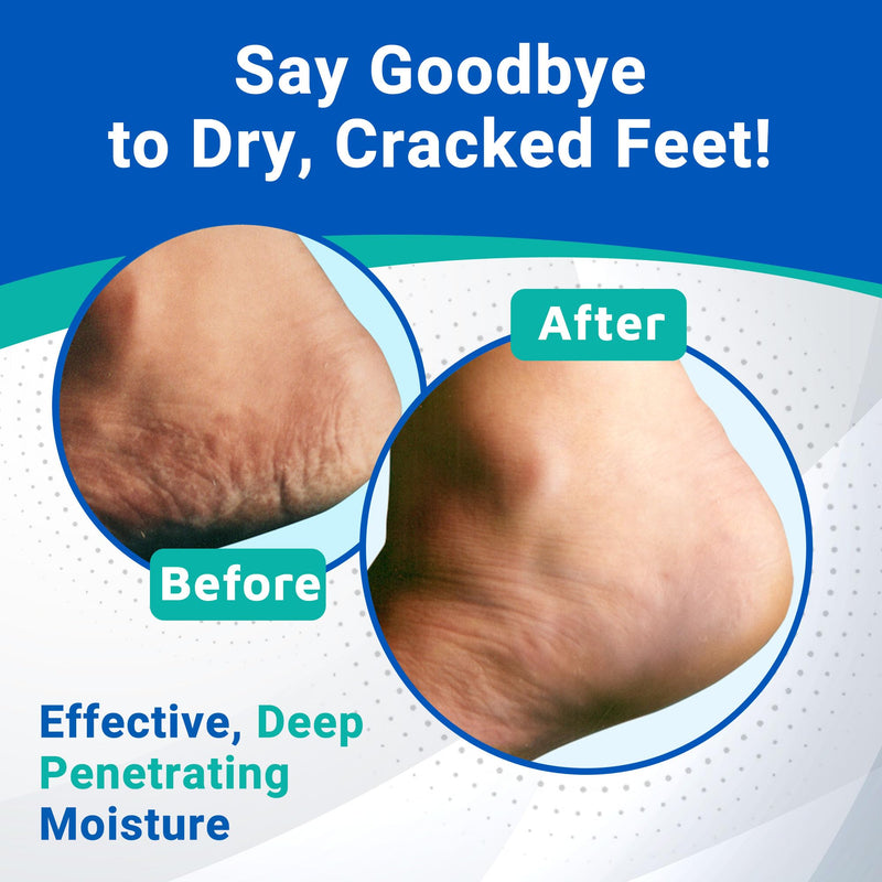Dermal Therapy - Heel Care Cream, Foot Cream for Dry Cracked Heels, Intense Foot Moisturizer with Urea and AHA, Foot Lotion and Feet Exfoliator with Non-Greasy Formula, 3 o.z. 3 Fl Oz (Pack of 1)