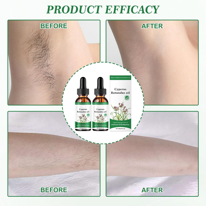 [Australia] - 2 Pcs Cyperus Rotundus Oil Cyperus Oil Cyperus Rotundus Cyperus Rotundus Oil Cyperus Oil for Hair Removal Cyprus Oil Reduces Hair Growth on the Body Suitable for All Skin Types 60 ml 