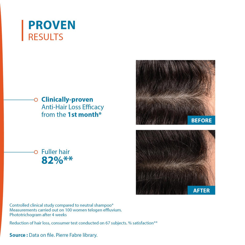 Ducray Creastim Reactiv Hair Loss Lotion 60 ml