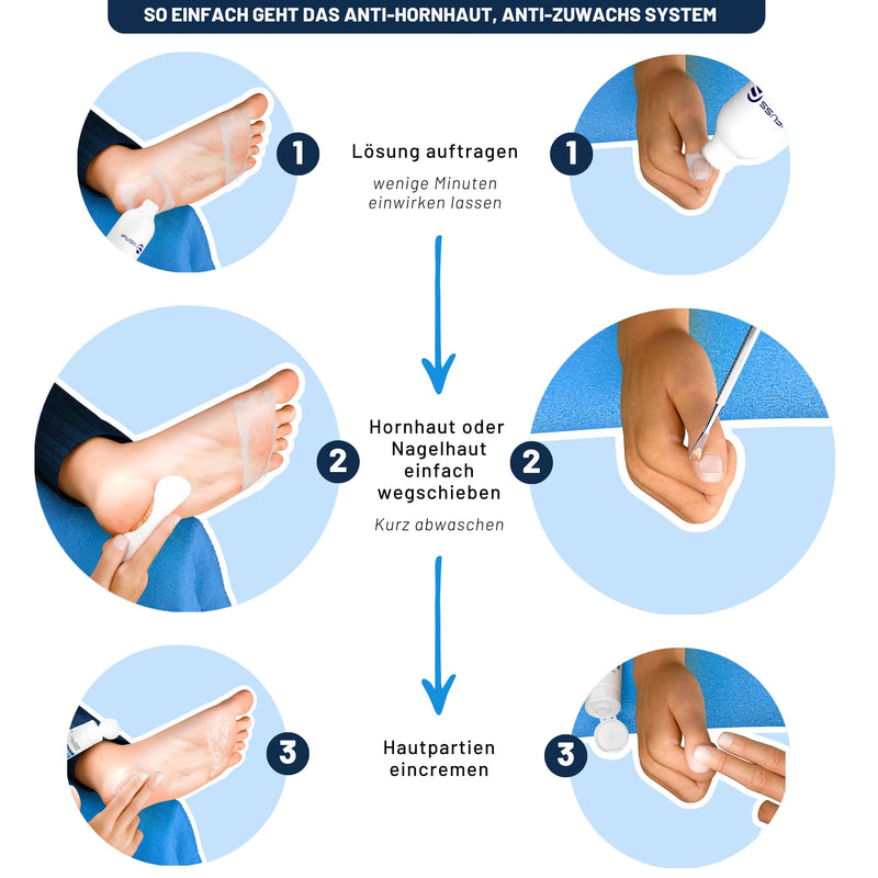 [Australia] - Mr. Fuss® No. 4 - Plus Pack Steel - Large, Cuticle Callus Remover Economy Pack 3 Pieces Active Solution Quickly Softening - 500 ml, Cotton, Stainless Steel Scraper 1 Piece (Pack of 1) 