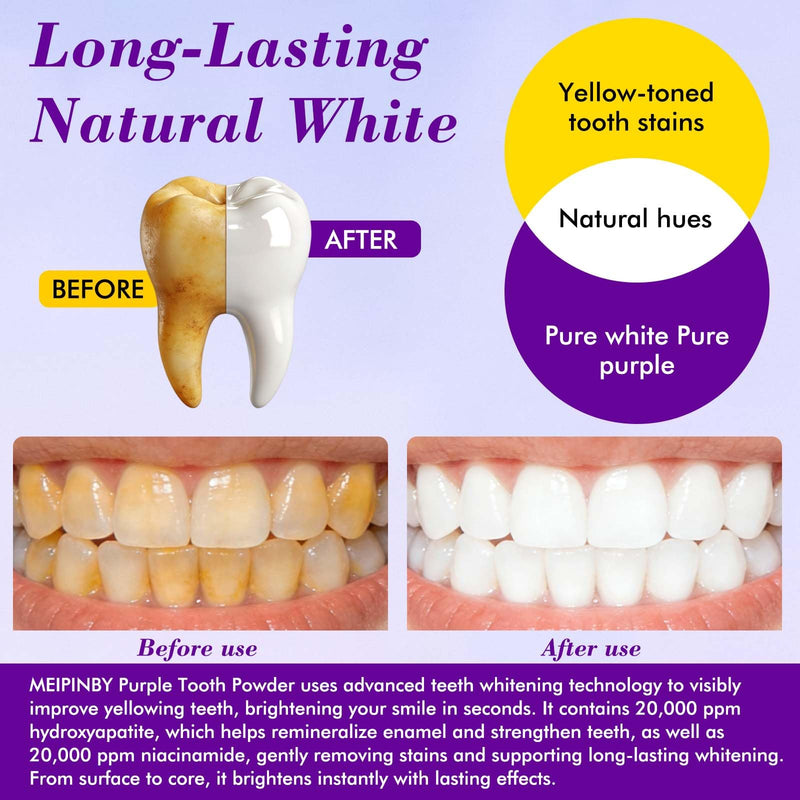 2 PCS Teeth Whitening Powder, Nano Hydroxyapatite Remineralizing Tooth Powder with Niacinamide,R5X Advanced Purple Color Balance Immediate Results, Mint Flavor, 2 * 50 Grams