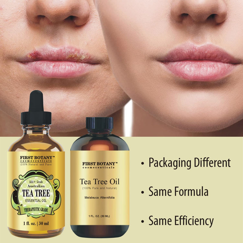 [Australia] - First Botany, 100% Pure Australian Tea Tree Essential Oil with high conc. of Terpinen - A Known Solution to Help in Fighting Acne, Toenail Issues, Dandruff. (1 fl oz) 1 Fl Oz (Pack of 1) 