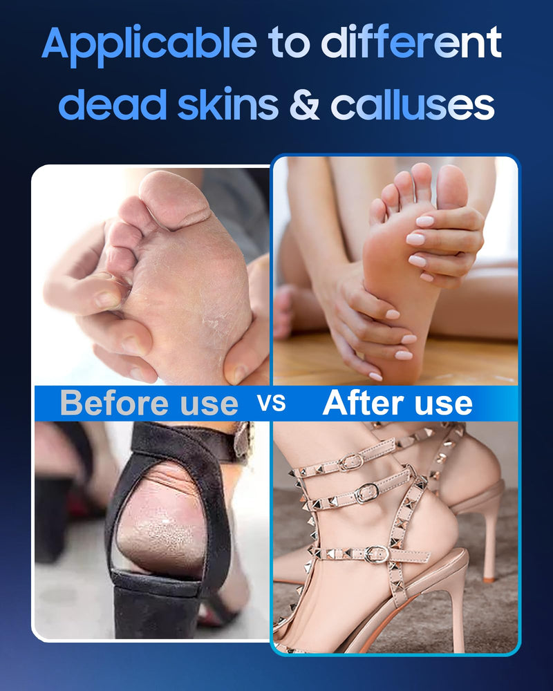 [Australia] - 11000 RPM Rechargeable Electric Foot Callus Remover with 2Glass Sander Discs - Cordless Foot Scrubber,Professional Pedicure Tool for Dead Skin and Calluses,Electric Foot File - Blue Blue - Rechargeable 