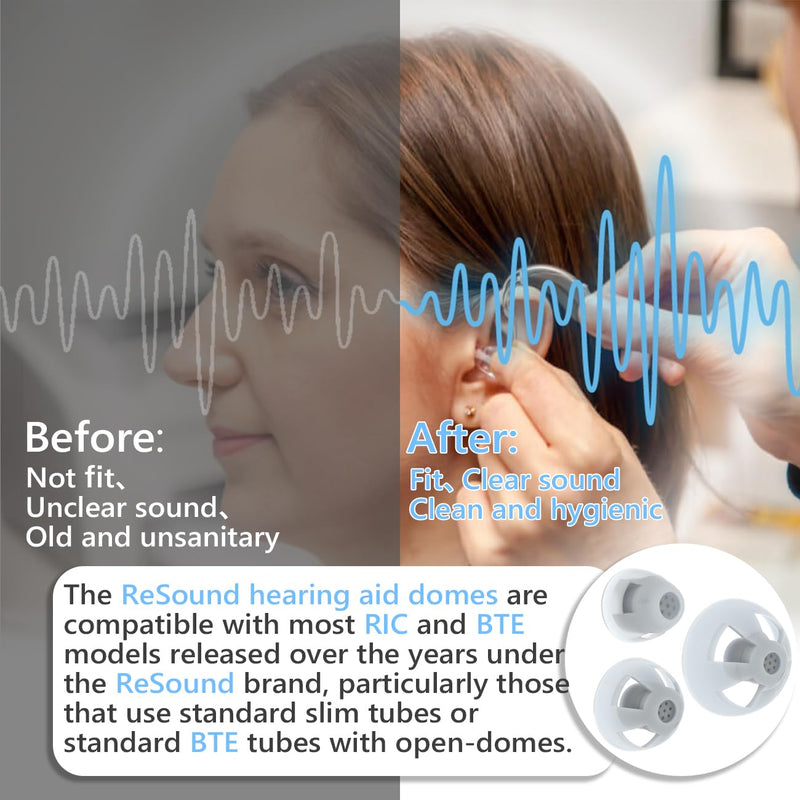 Resound Open Domes for Hearing Aid Comfortable Silicone Design Noise Reduction Enhanced Acoustics Breathable and Easy to Clean Hearing Aid Accessories Resound Hearing Aid Domes (Gray, Mix-12pcs) Gray