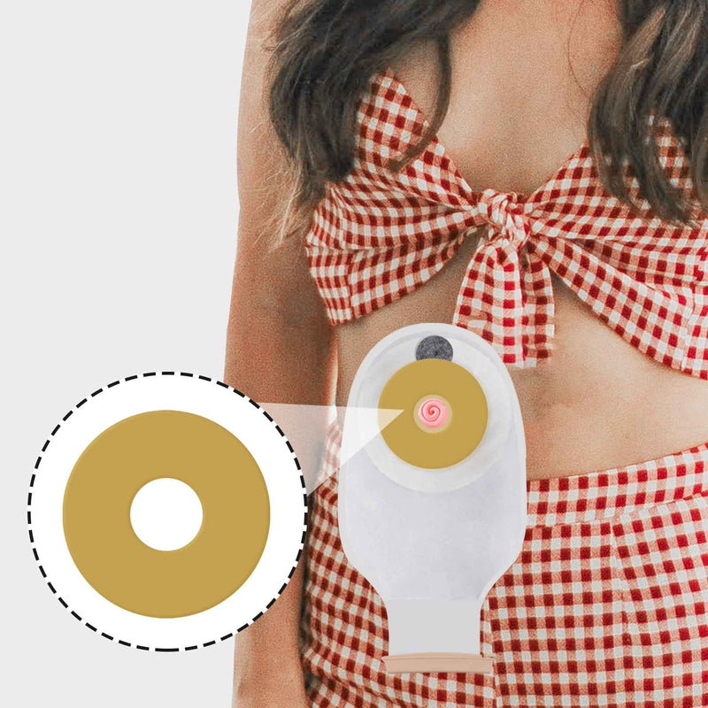 [Australia] - 10Pcs 2mm Ostomy Barrier Rings, Moldable Ostomy Rings, Hydrocolloid Skin Extender Rings for Colostomy Bags,Sting-Free Ostomy Supplies 
