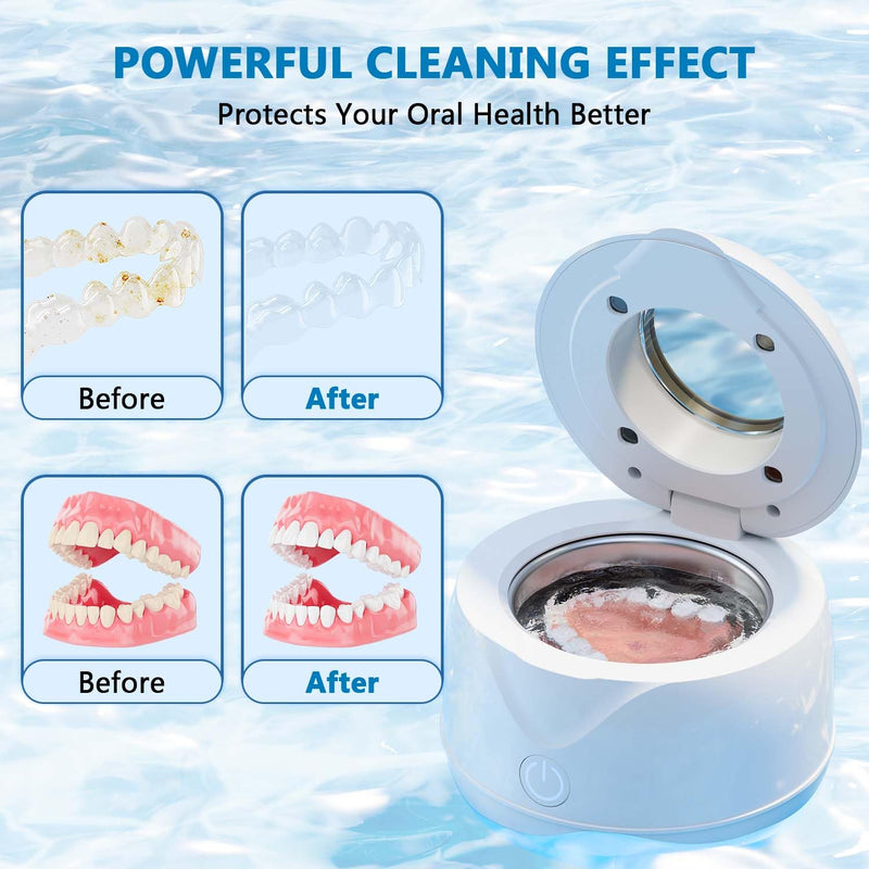 [Australia] - Ultrasonic Retainer Cleaner Machine 45kHz 200ml Portable Ultra Sonic Retainer Cleaner for Dental Retainer Mouth Guards Aligner Night Guard Braces Toothbrush Jewelry 