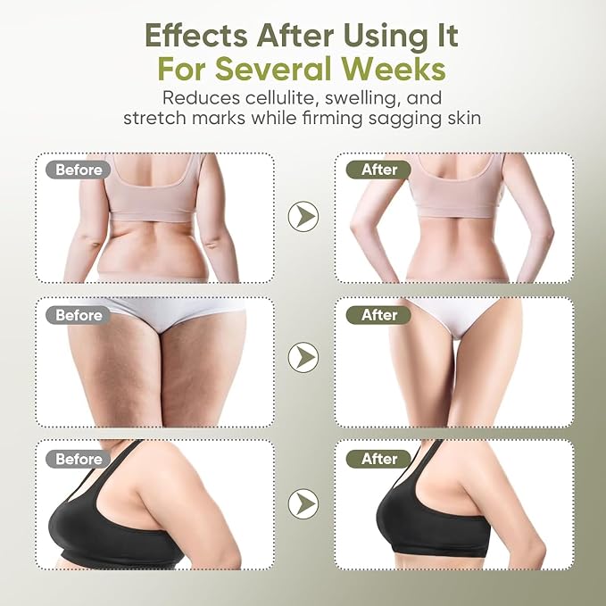 Lymphatic Drainage Massager for Full Body, Body Sculpting Machine & Cellulite Massage Tool for Skin Smoothing, – Relieves Muscle Tension, Reduces Cellulite, and Enhances Skin Firmness