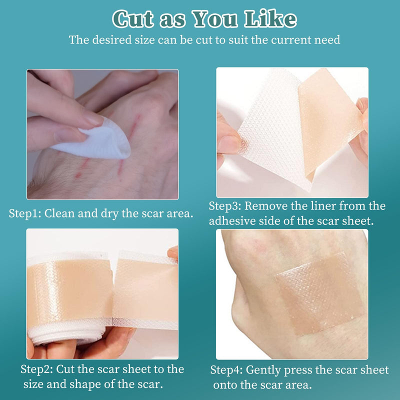 [Australia] - Cozlly Silicone Scar Plasters (1.6'' x 118''/4 x 300cm), Silicone Plasters for Scars, Silicone Scar Sheets, Professional for C-Section Scars, Surgery, Burns, Keloid, Acne and More 