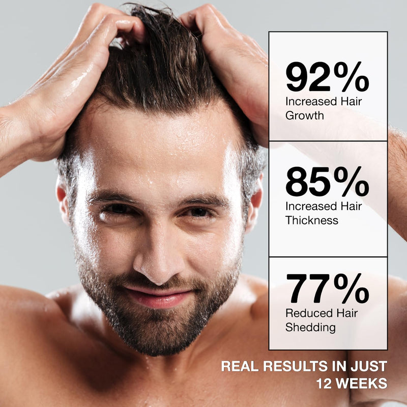 Root Activator Shampoo for Men: Hair Growth Shampoo for Hair Loss and Thinning Hair - 10.1 fl oz / 300 mL Root Activator Shampoo 10.1 Fl Oz (Pack of 1)