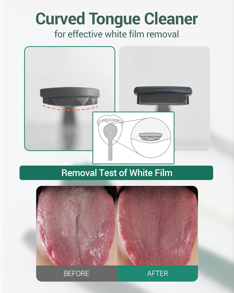[Australia] - DEARCUS Korean Tongue Scraper with 3 Replaceable Heads - 100% BPA Free TPE Tongue Cleaner - Reduce Bad Breath & Without Hurt - Hygienic Scraper - Modern & Simple Design (White) White 