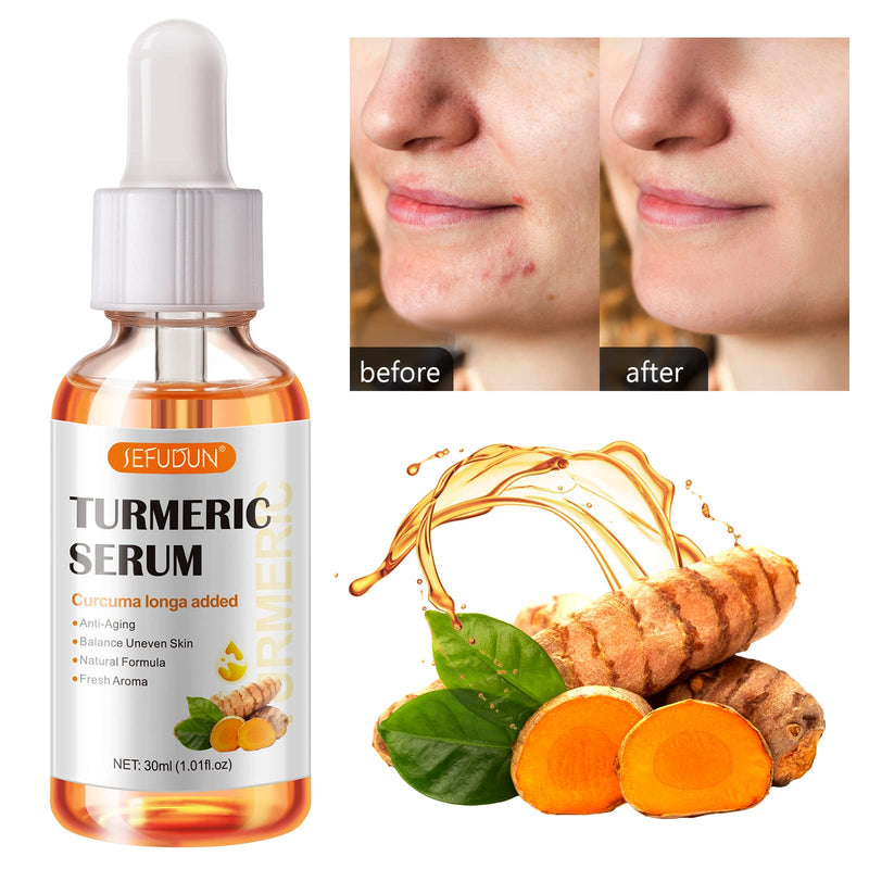 2 Pack Turmeric Serum for Dark Spots, Turmeric Dark Spot Corrector Serum for Acne, Hyperpigmentation and Smooth Skin, Formulated with Hyaluronic Acid, Vitamin C & E - 1.01 FL.OZ 1.01 Fl Oz (Pack of 1)