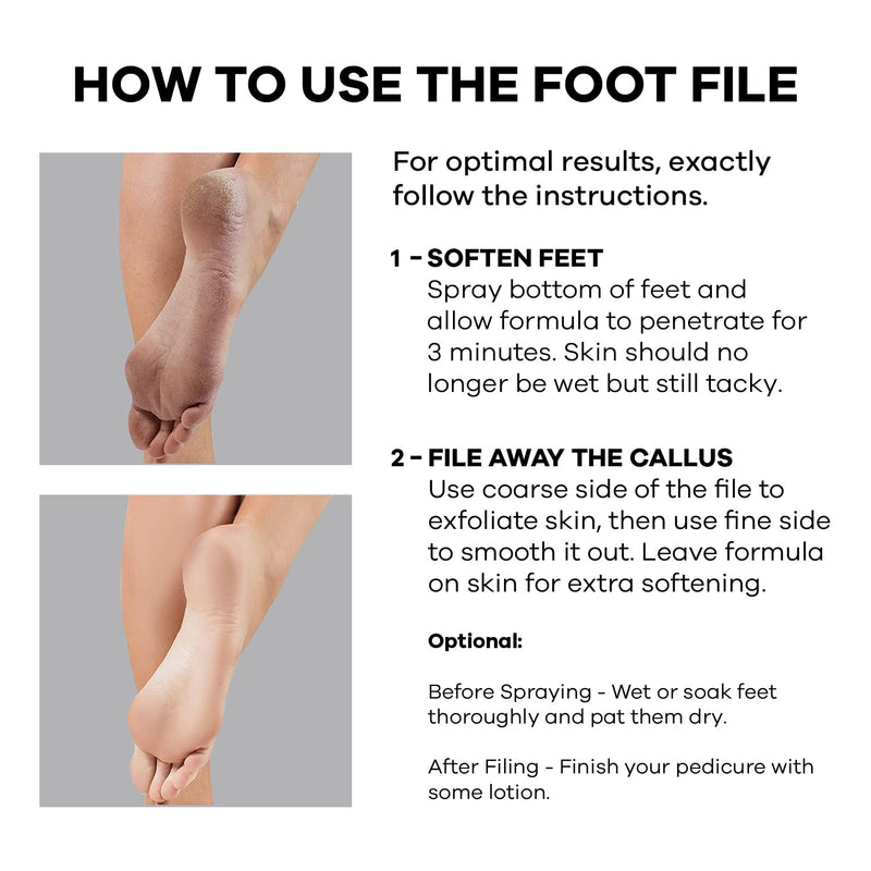 [Australia] - Dermasuri Callus Remover Foot Scrub - Exfoliating Feet Spray-on Formula and Reusable Deluxe Foot File - Dead Skin Remover, Callus Rasp, Scrubber, Peel & Soften Cracked Heels - Deluxe Pedicure Spa Kit 