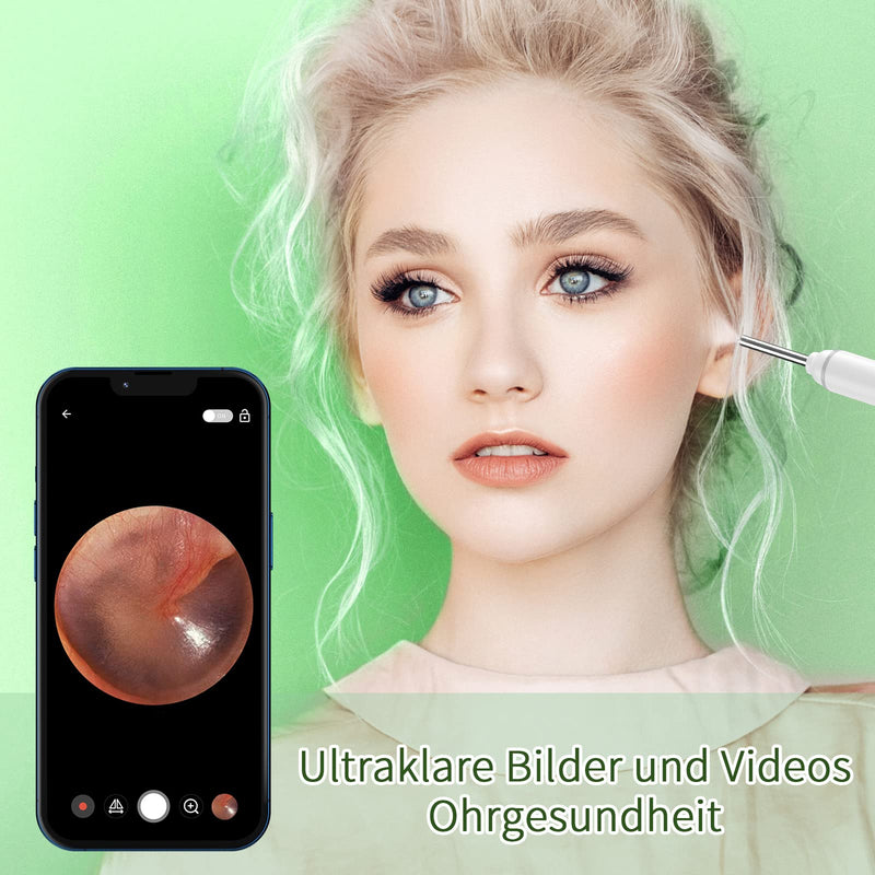 [Australia] - Earwax Remover Otoscope, VITCOCO 1920P Wifi Ear Cleaner, Ear Cleaner with Camera, Otoscope with 6 LEDs for iPhone, iPad and Android Smartphones, White 