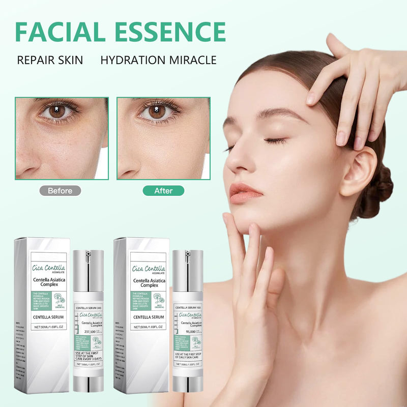 [Australia] - YANINEE 2 pieces 50 ml Needle Shot 100 300 serum with Centella complex 
