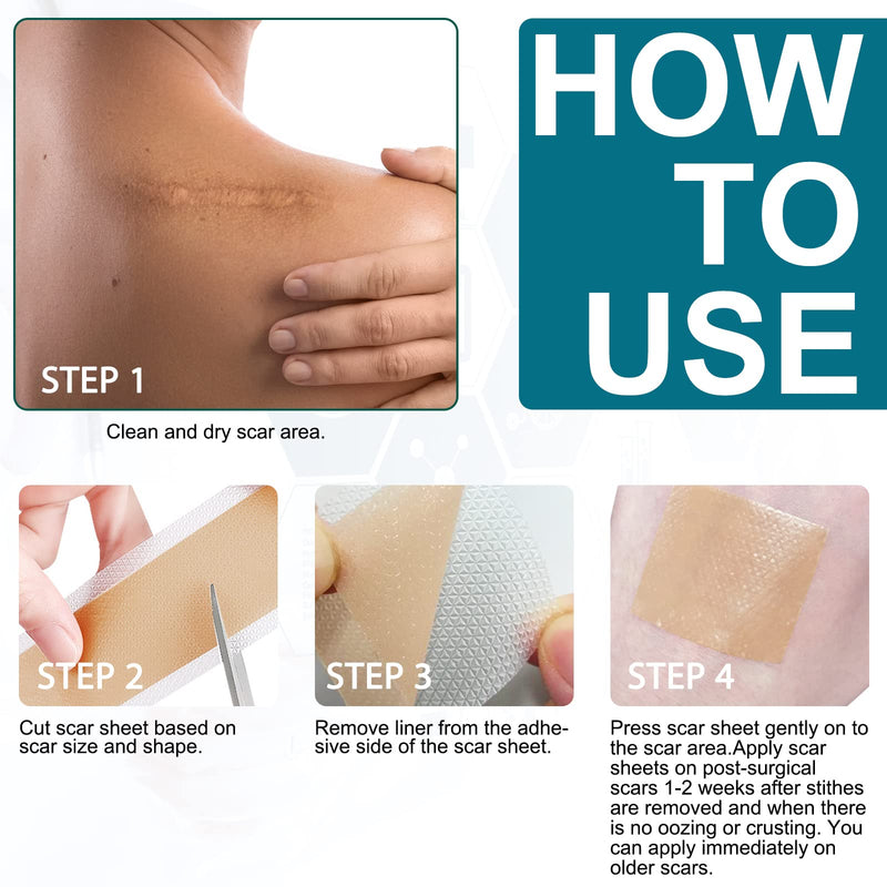 [Australia] - Silicone Scar Plaster, Professional for C-Section Scars, Surgery, Burns, Keloid, Acne and More, Drug Free, Silicone Scar Roller(4CMx300CM) 4CMx300CM 