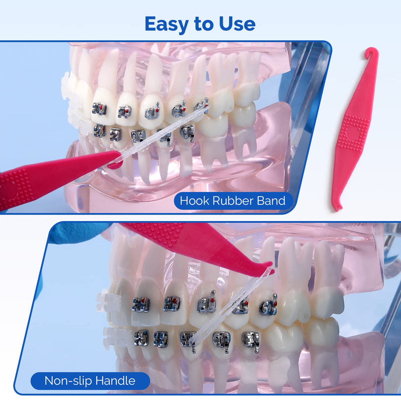 [Australia] - JMU Orthodontic Rubber Bands 1/4 Medium 6.4 mm Clear Orthodontic Elastics 4.5oz 500 pack Latex Free Dental Rubber Bands Made in USA 