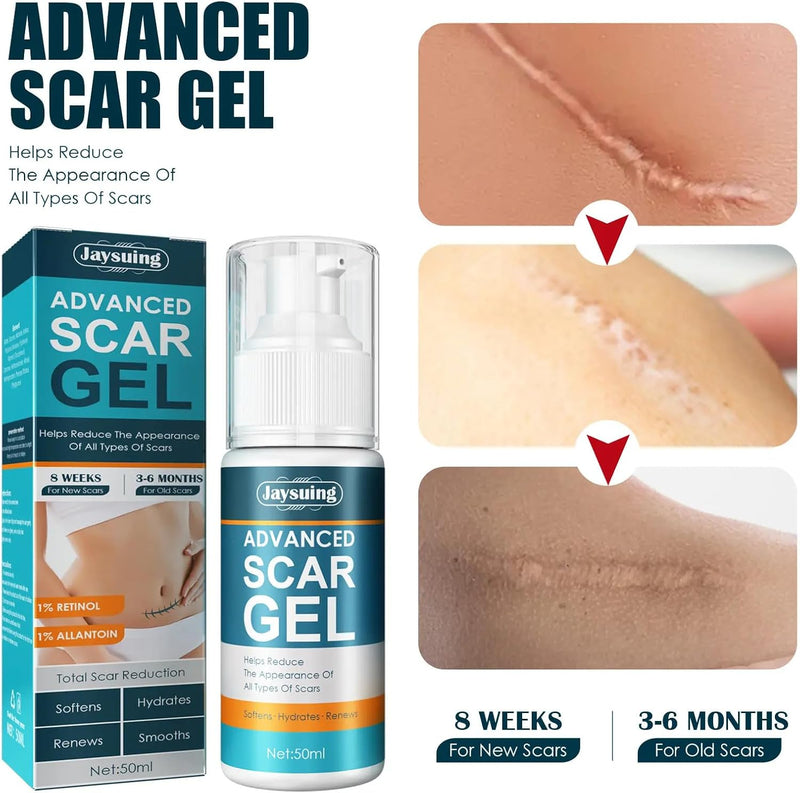 Silicone Scar Cream Scar Gel - Advanced Scar Gel Scar Treatment for Stretch Marks Removal, Old & New Scars, Surgical Scars, Burns, Acne, C-Section, Keloid Scar Treatment for Women & Men, 1.76Oz