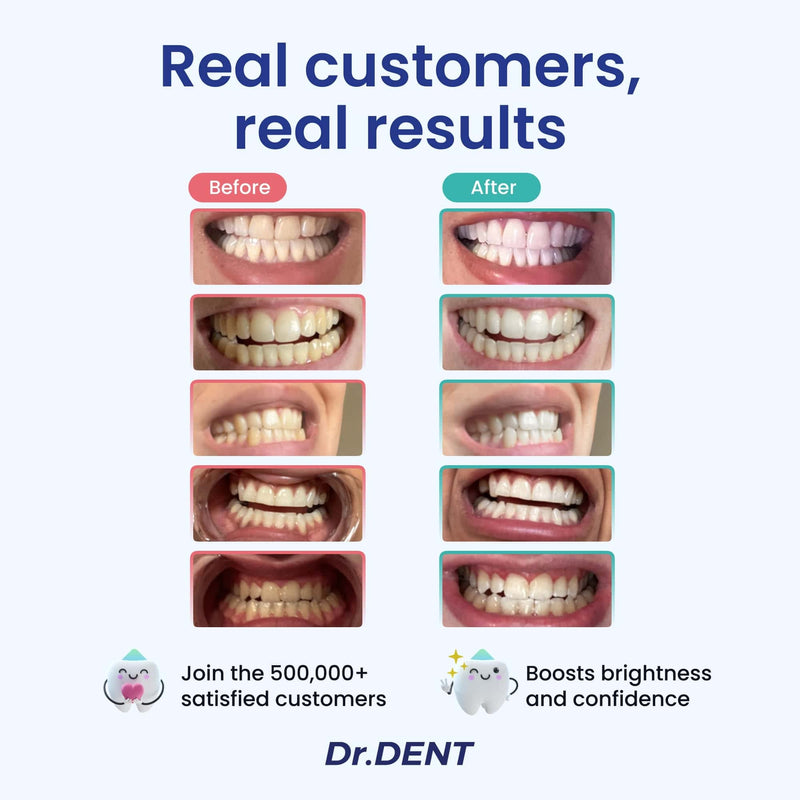 [Australia] - DrDent Professional LED Teeth Whitening Kit - Carbamide Peroxde Sensitivity Free Formula - (3) Teeth Whitening Gel Pens 30+ Whitening Sessions - (1) Remineralization Gel - Rapid & Effective Results 