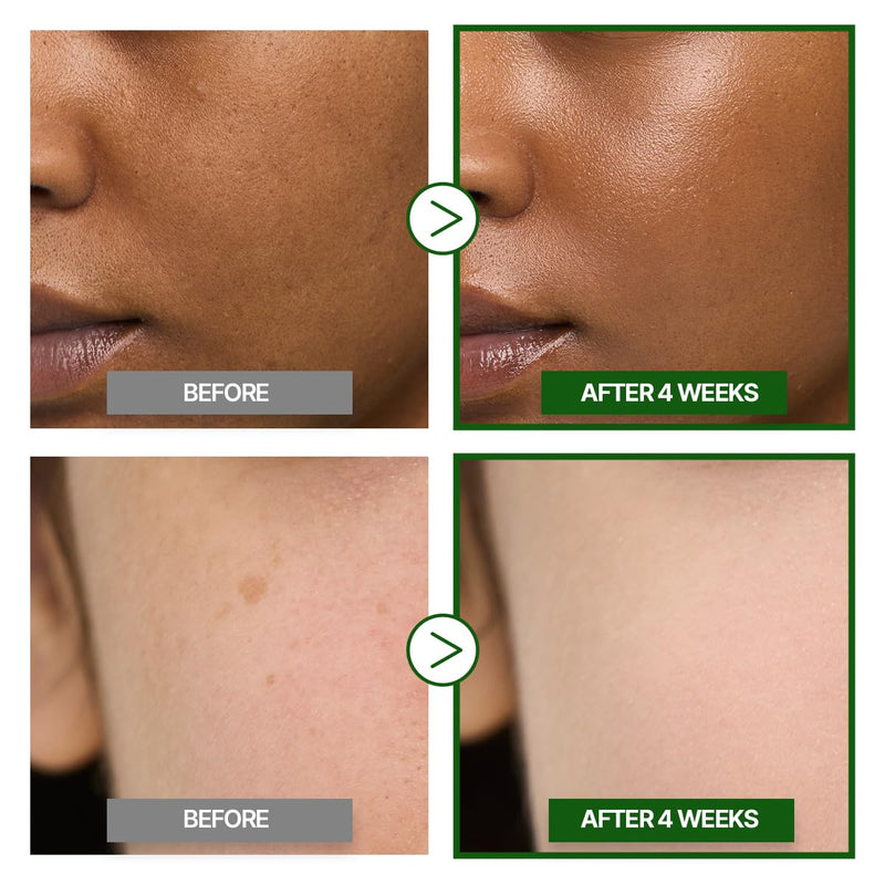 GOODAL Green Tangerine Vitamin C Cream [Advanced Ver.] – Vitamin C Cream with 5% Niacinamide | Fades Dark Spots, Boosts Radiance & Hydrates | Korean Skincare 1.69oz / 50ml Green Tangerine [Advanced]