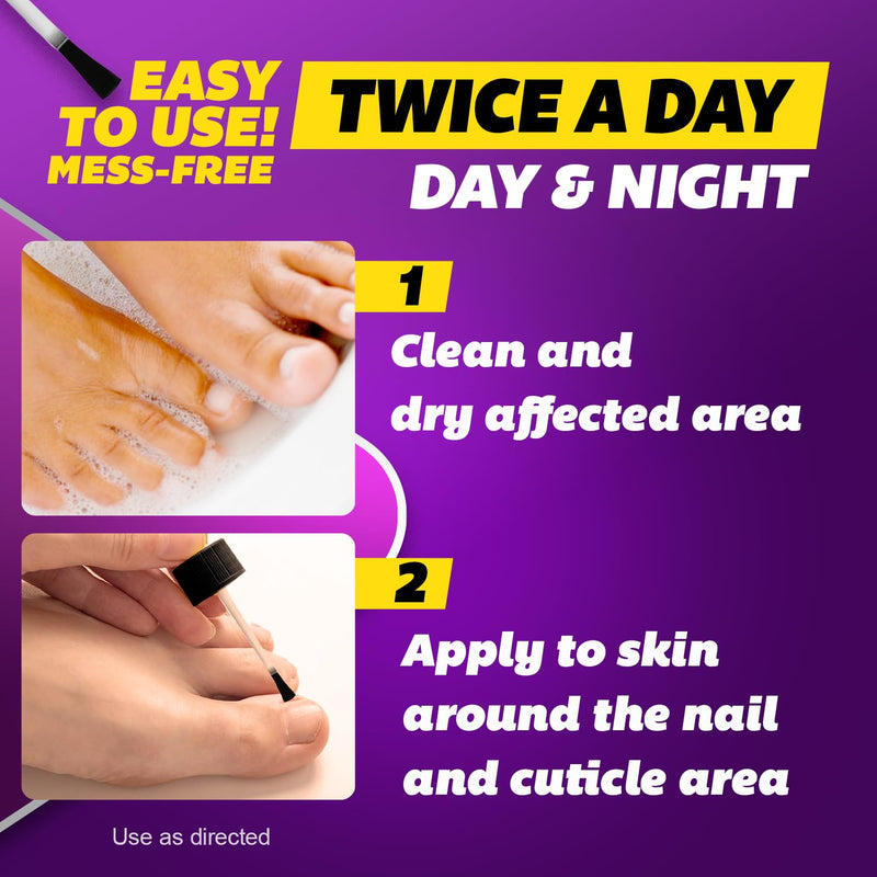 SILKA Max Strength Antifungal Liquid for Toenail Health with Brush Applicator, Results in 1 Week, Nail Fungus Treatment for Damaged Toenails, Athlete's Foot Treatment, Tolnaftate 1% 0.45 Fl Oz 0.45 Fl Oz (Pack of 1)