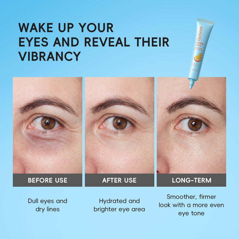 QUIYUM Citrus Vitamin C Eye Cream, for Dark Circles and Puffiness, 0.71 Oz | Glowing Eye Moisturizer with Caffeine, Hyaluronic Acid & Collagen, Under Eye Cream to Smooth Fine Lines, Non-Greasy