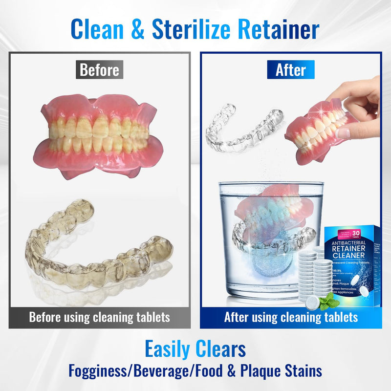 [Australia] - Retainer Cleaner Tablets for Invisalign,30 SULPHATE-free Effervescent Denture Cleaner with Aligner Tools Remove Stains ＆Odors -Mouth Guard Cleaner Night Guard Cleaner Tablets for Ultrasonic Cleaners 30 