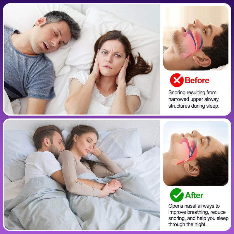 [Australia] - Nasal Strips for Snoring, 100 Count Extra Strength Nose Strips for Breathing, Anti Snoring Devices for Sports and Sleep, Help Stop Snoring, Relieve Nasal Congestion, Drug-Free,Deeper Sleep Tan-100 Count 