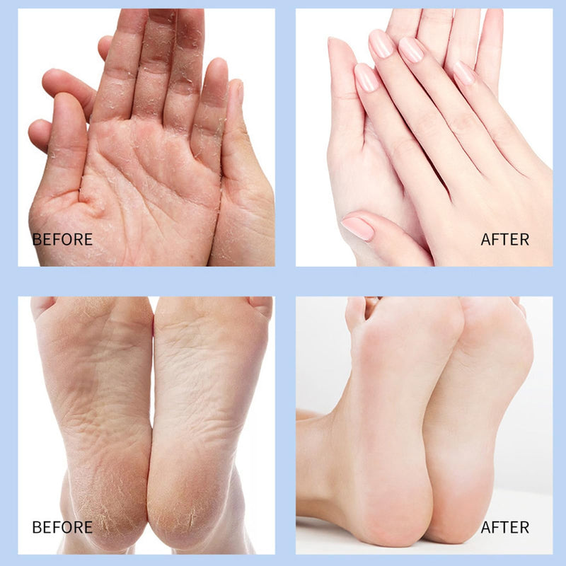 [Australia] - Crack Feet Prevention Stick, Anti Crack Foot Cream Stick, Foot Care Cream Cracked Feet, Moisturizing Foot Balm, Softening and Nourishing Cream for For Dry Heels 2 