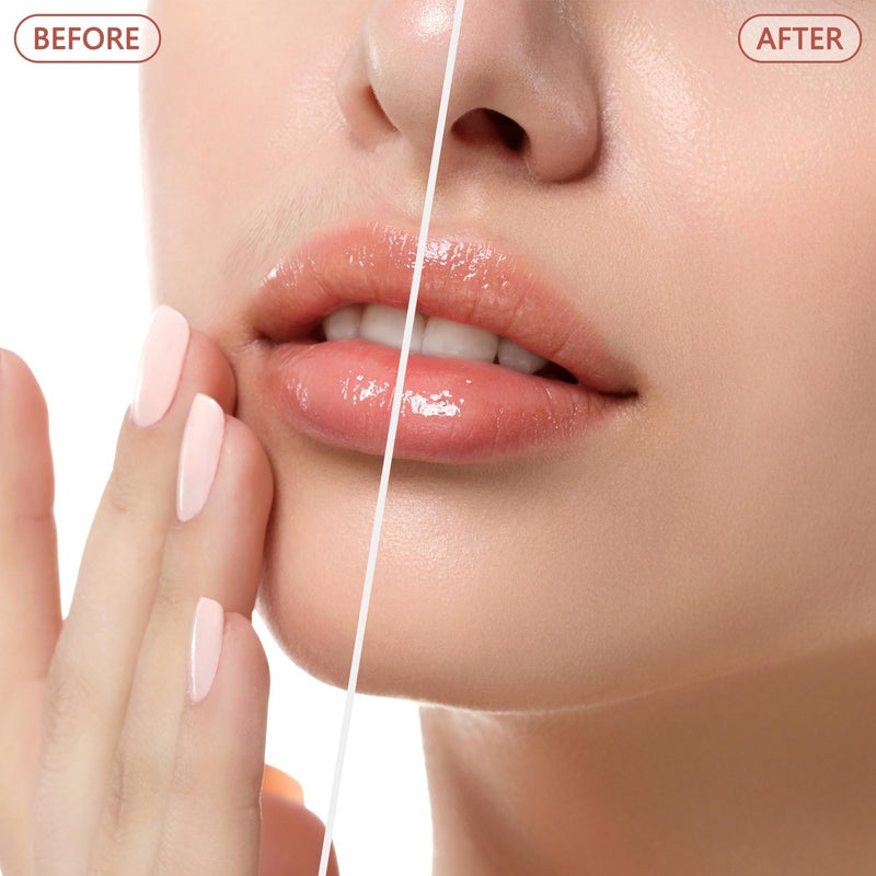 [Australia] - Facial Hair Remover for Women - as Seen on TV Painless Face Shaver - Electric Hair Removal Device for Face Lips Peach Fuzz with Light (Blue) Blue 