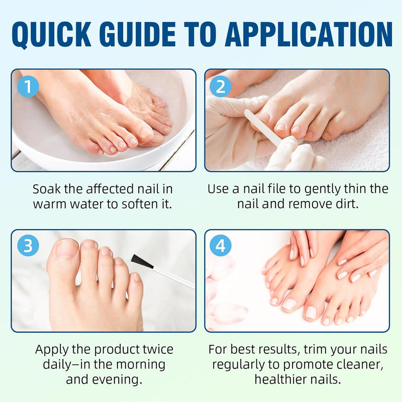 [Australia] - Toenail Fungus Treatment Extra Strength with 25% Undecylenic Acid, Ingrown toenail treatment, nail repair, Fungus nail treatment, yellow toenail, Damaged Nails foot fungus treatment extra strength 2 Fl Oz (Pack of 1) 