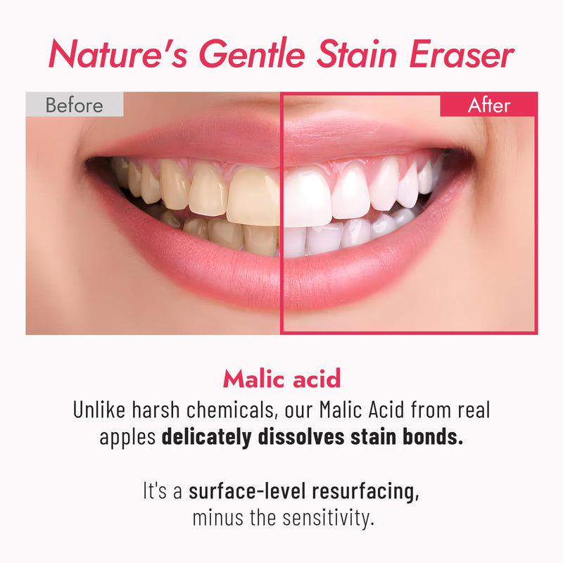 MALIC Acid Teeth Whitening Toothpaste,Natural Care Deep Stain Removal&Plaque,Fluoride Free,Non Toxic,for Adults, Kids and Sensitive Teeth，with Niacinamide，3.57oz.
