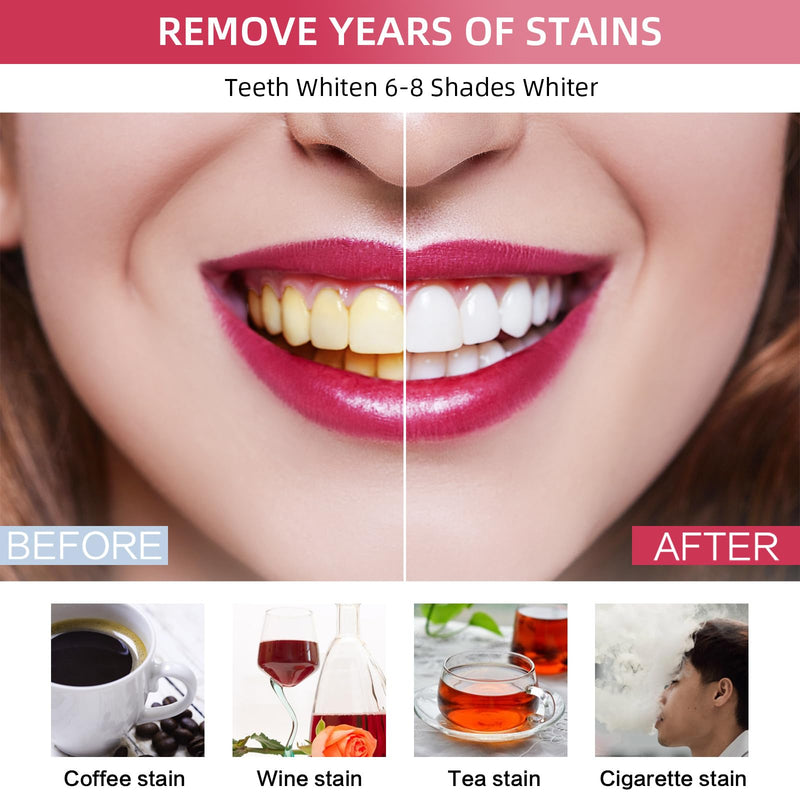 [Australia] - Professional Teeth Whitening Kit with 5 Teeth Whitening Gel, LED Accelerator Light & Rechargeable Design - Enamel Safe Gel, Custom Trays, Fast Results for Sensitive Teeth - Whitening Gel Kit 