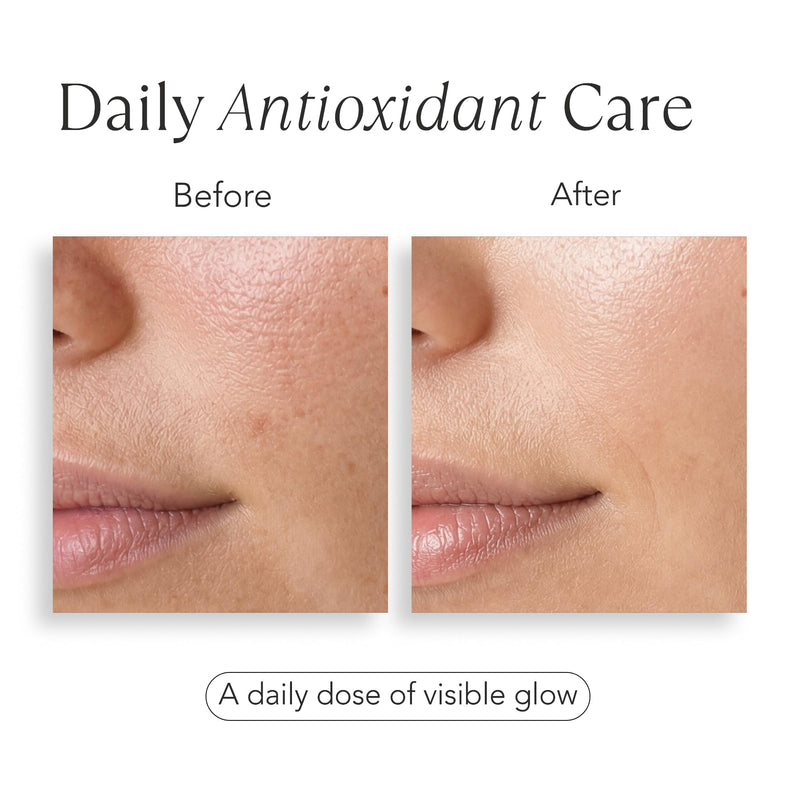 Orgev Vitamin C 20% Dual-Chamber Fresh-Activated Serum – Pure 20% L-Ascorbic Acid Powder Professional Face Treatment – High-Potency Antioxidant for Brightening, Firming & Collagen – 12-Day Potency