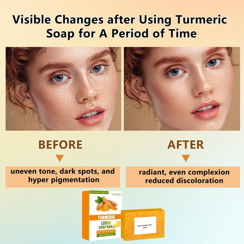 Turmeric Soap Bar - Handmade Lemon & Ginger Soap Bar, 100% Natural Brightening for Dull Skin, Antioxidant Face & Body Soap, Outdoor Home Use, Fit All Skin Type 4.1 oz Turmeric