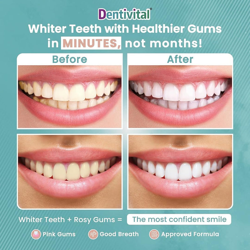 [Australia] - Teeth Whitening Strips, 60 Strips (30 Treatments) – Zero Sensitivity Whitening with Enamel Strengthening & Gum Revitalization – White Strips for Deep Stain Removal with Dry Non-Slip Technology 